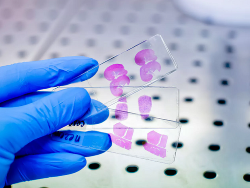 Would You Trust AI to Diagnose Cancer?