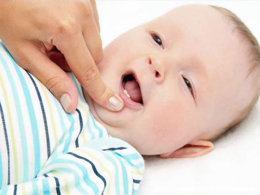 UNDERSTANDING TONGUE-TIE