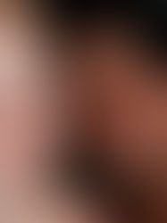 Redefiniendo la salud de la piel: el impacto del microbioma en tu cuidado diario