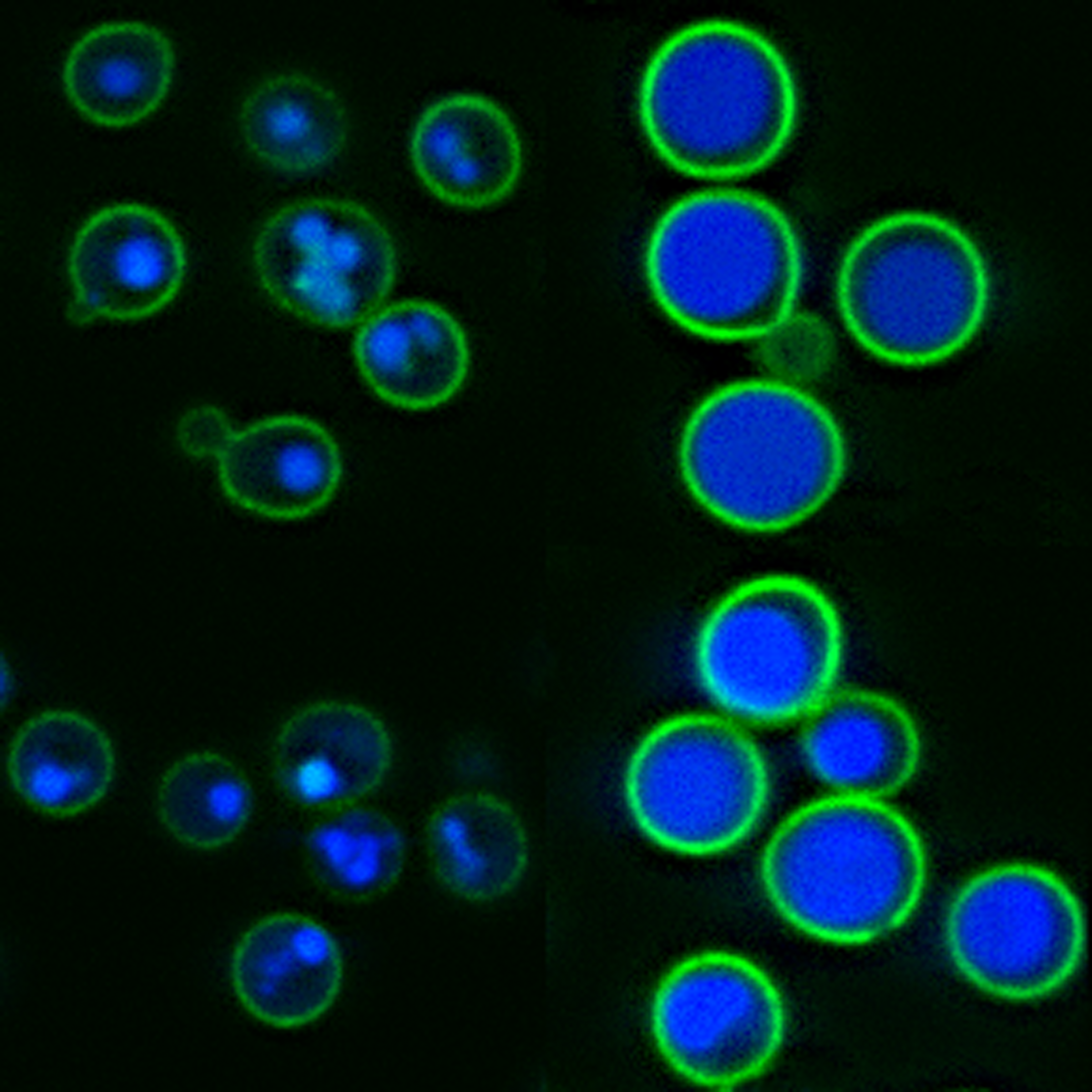 Yeast images WT vs rsp5 mut