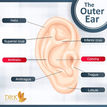Protruding ears or Bat Ears