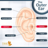 Protruding ears or Bat Ears