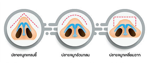 NoseTip Refinement