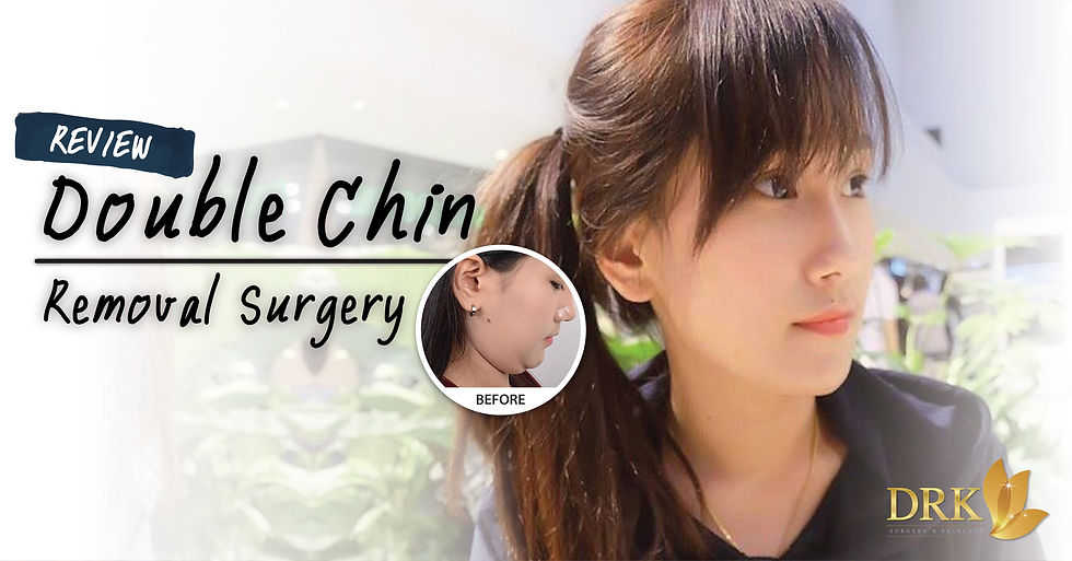 Double Chin Removal