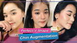 How to be Korean in one cosmetic surgery? The VShape Face from DRK can make it happen!