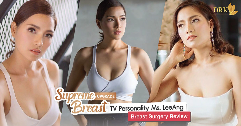 Breast Augmentation