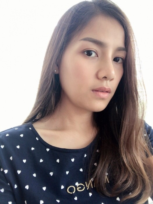 rhinoplasty nose