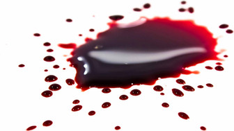 If It Bleeds, It Leads