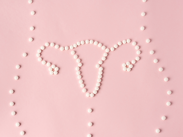 Polycystic Ovary Syndrome