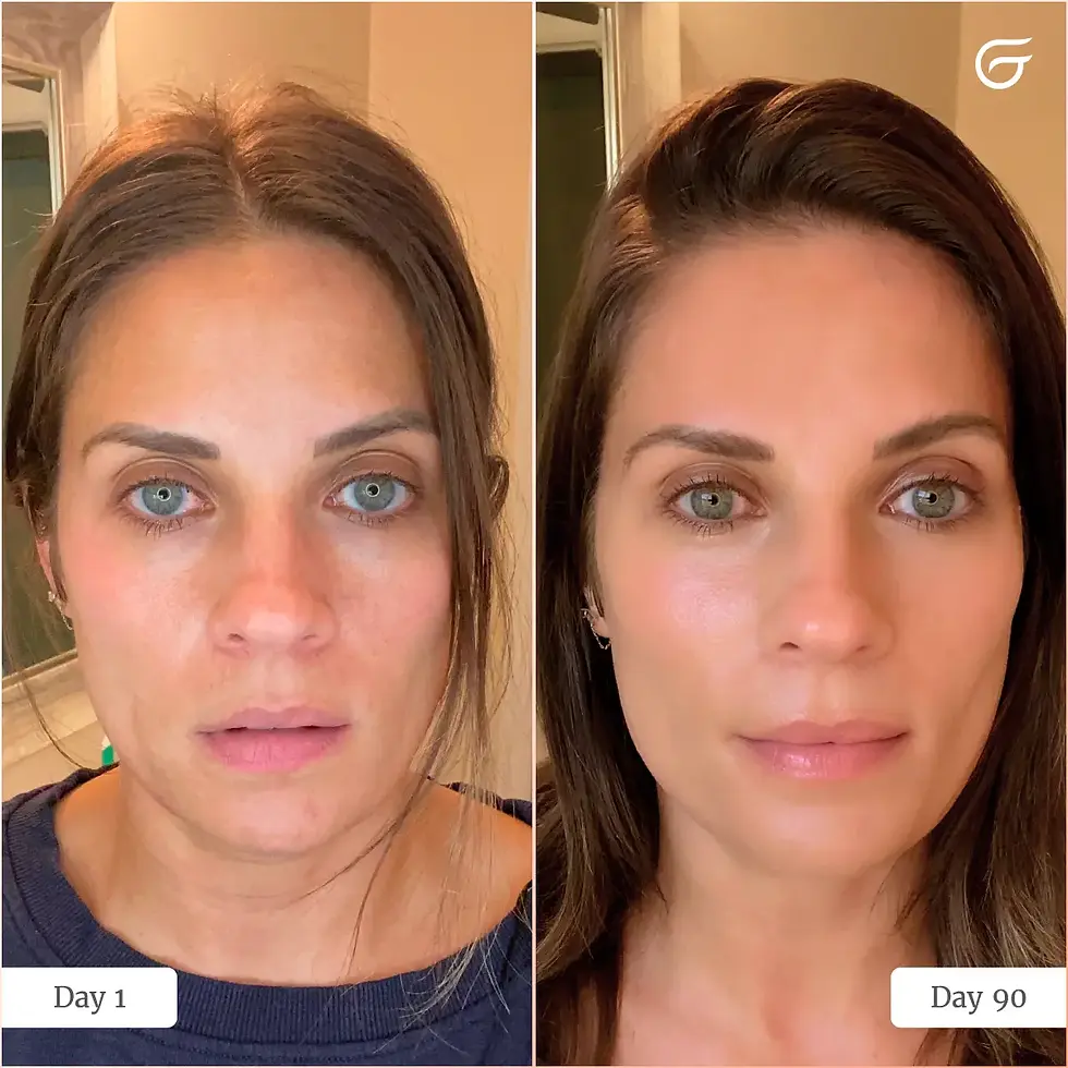 Thumbnail: Before and after results showing improved skin tone after using LED light therapy.