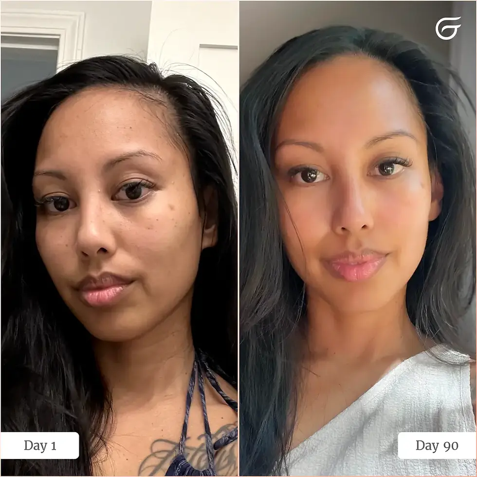 Thumbnail: Side-by-side photos of different women with smoother, glowing skin from LED therapy.
