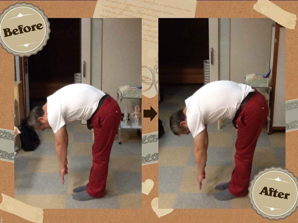 ビフォーアフター