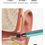 Thumbnail: iTiMO Y9 Intelligent Visual Ear Pick Endoscope