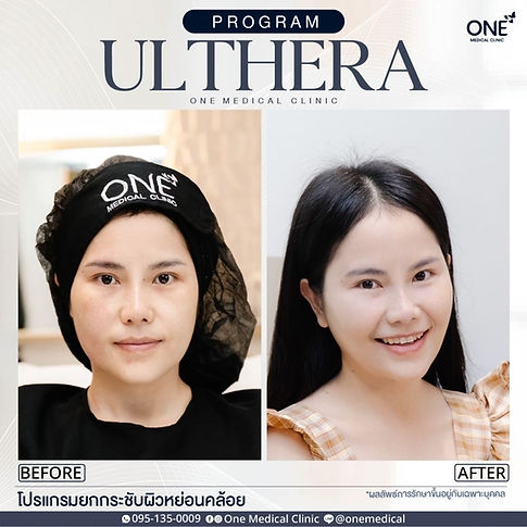 UTR คุณเอียร์.jpg