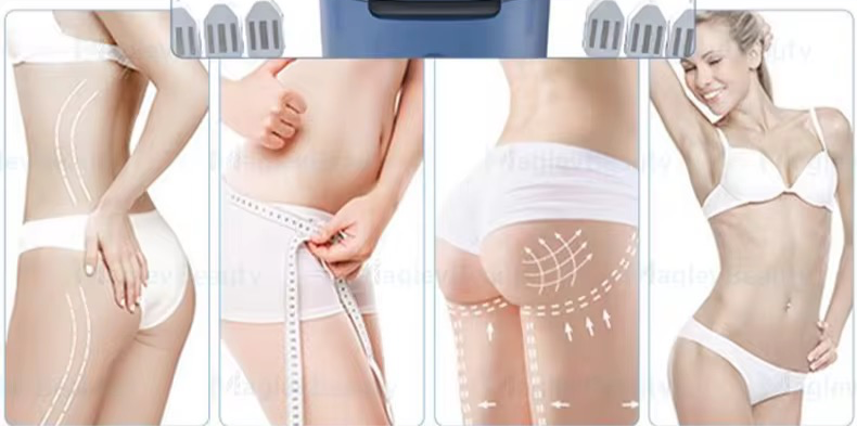 🖐 Trustsculpt Arme Abo – Für dauerhaft straffe Oberarme