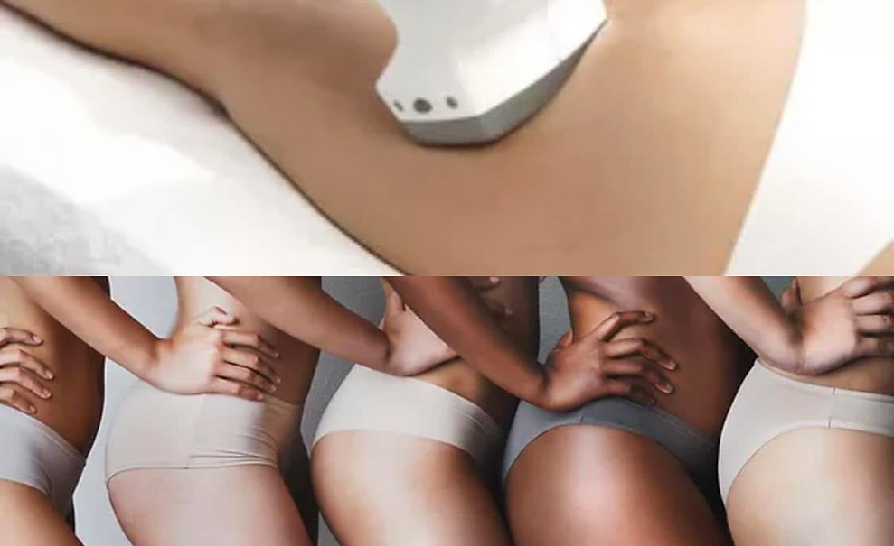 Magic Shape Maschine kombiniert Wärme bis 50°C mit speziellen Massagewalzen für eine effektive Fettverbrennung, Cellulit
