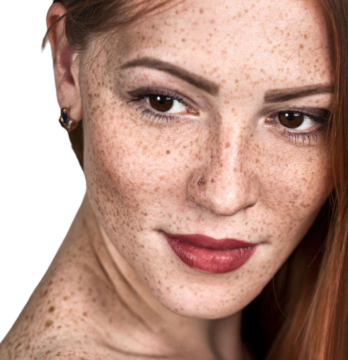 Pigmentfleckenentfernung Augenringe - Kosmetikstudio Vesna