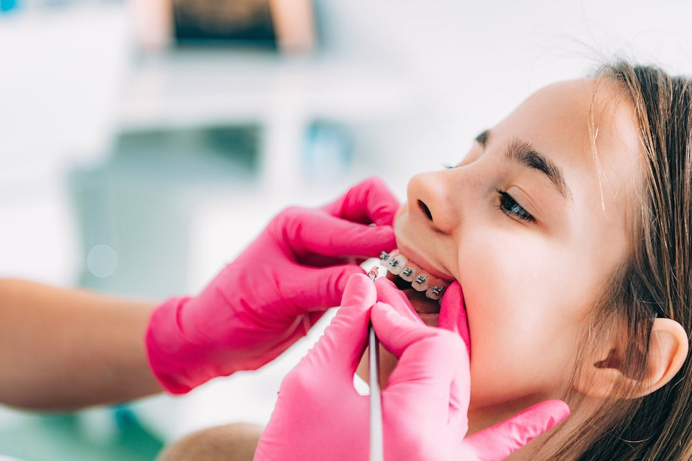 Young girl with braces being checked on by orthodontist