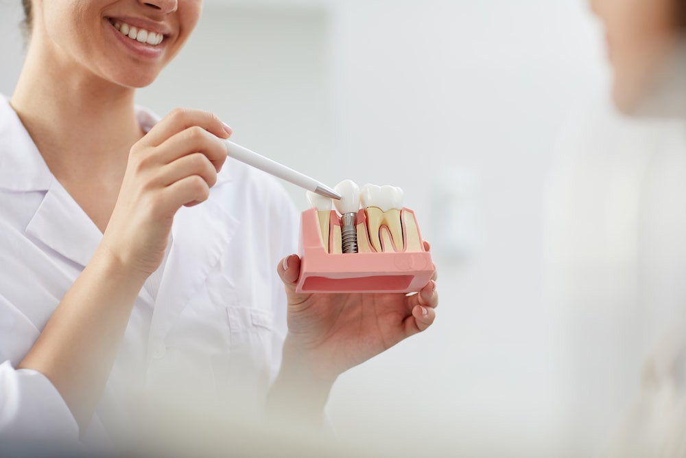 Female dentist smiling while pointing to a dental implant