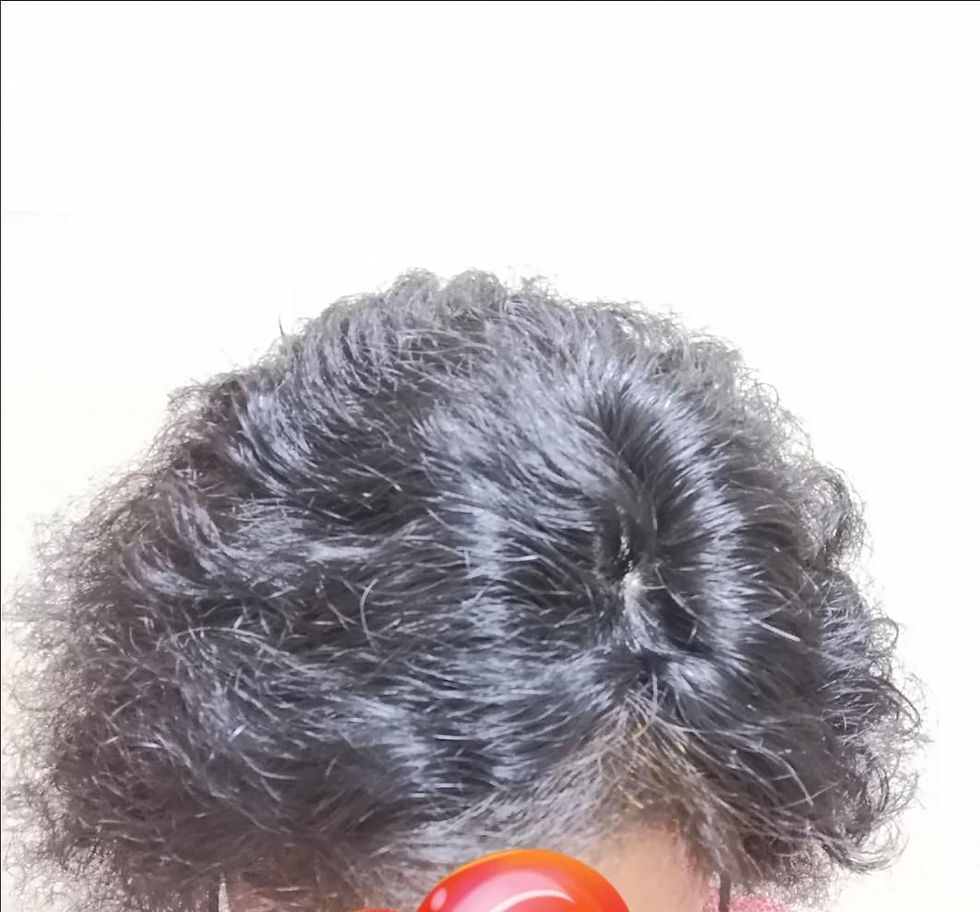 Thumbnail: BISCUITS 8x5cm Base Curly Human Hair topper for thinning hair or Alopecia help .