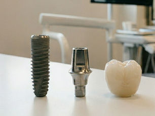 Restore your smile with All-on-4 dental implants in NYC and NJ. Learn benefits, cost, procedure, and recovery at Bright Smile Design Dental.