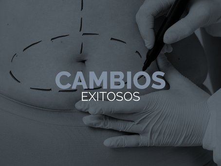 Los secretos para una recuperación exitosa después de una cirugía estética