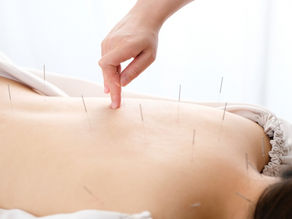 私が鍼(はり)治療を大好きで、おススメする理由(五反田 鍼灸院)