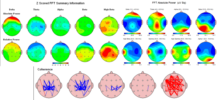 we all have our own beautiful brain maps, constantly changing. image courtesy of the Institute of Functional Neuroscience, http://www.ifn.net.au/what-is/