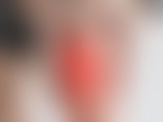 Understanding Patellofemoral Pain: How Exercise Can Help