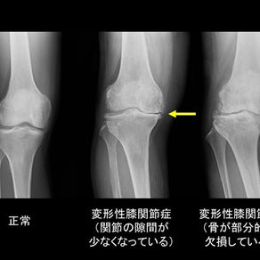 リハビリが効果的な病気・症状とは？～疾患別アプローチの考え方