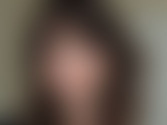 Franja: Qual Escolher? Descubra Como Ela Pode Transformar Seu Visual!