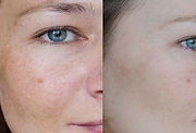 Skin Tone