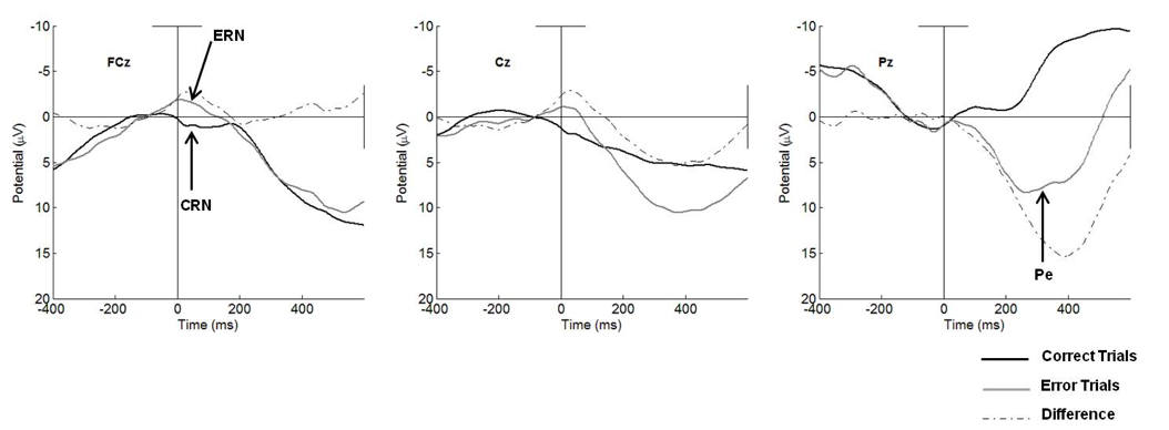 Event-related potential waveforms showing the error-related negativity