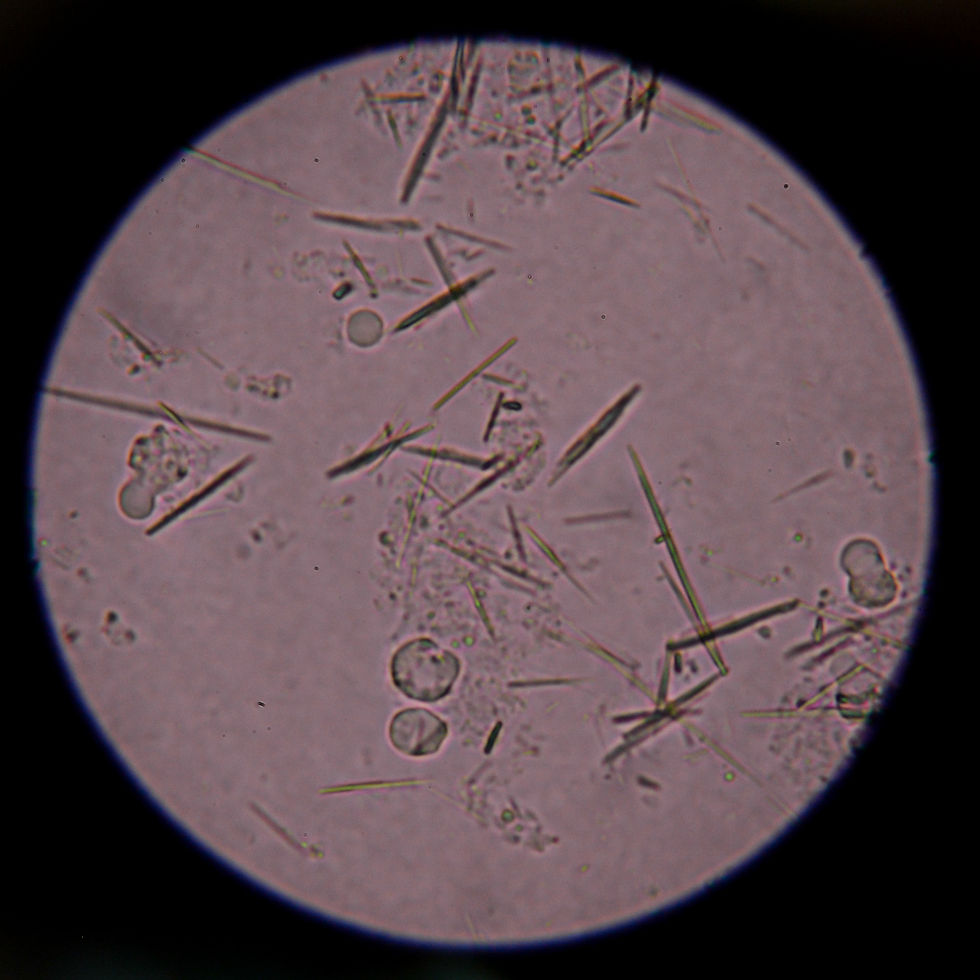 Urine may have crystals, debris, but should not exhibit live bacteria.