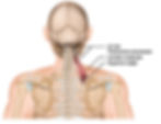 The Levator Scapulae elevates the head, elevates the shoulder and is easily injured