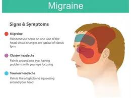 migraine signs and symptoms