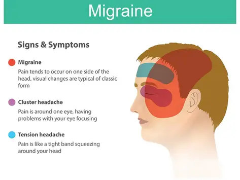 migraine signs and symptoms