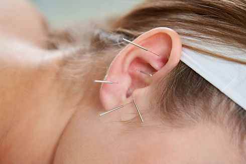 beautiful-woman-relaxing-on-a-bed-having-acupuncture-treatment-with-needles-in-and-around-