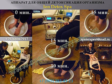 аппарат для общей детоксикация организма