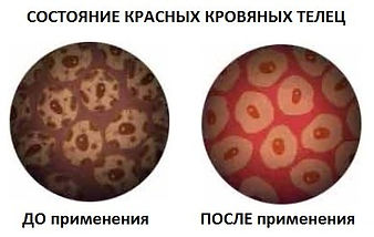 массаж на дому планерная