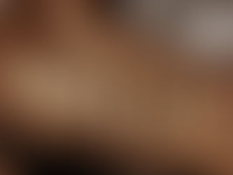 Ghana confirms two new Mpox cases – Prof. Kaba Akoryea urges public vigilance