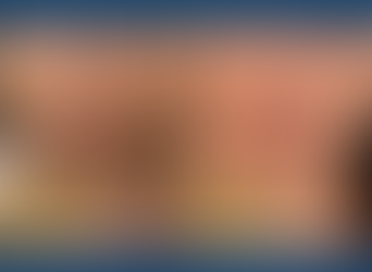 How to Make Your SQT Bio-Microneedling Treatment Truly Effective