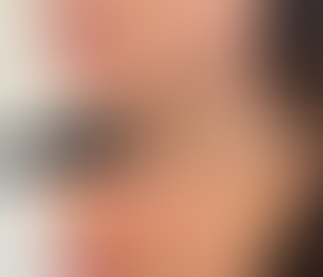 Neck and Face Thread Lifts – What to Expect from Non-Surgical Lifting & Contouring