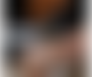 Queensland’s Top SQT Bio Microneedling Clinics: Certified Providers & Facial Treatments