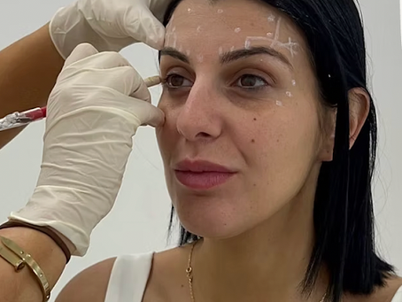 Forehead Lines & Expert Cosmetic Consultations: Wrinkle Treatment Gregory Hills