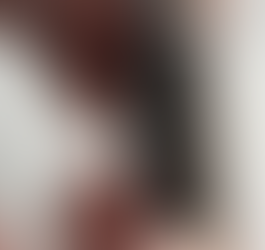 SQT Facial Rejuvenation: Results, Spongilla Spicules & Session Planning