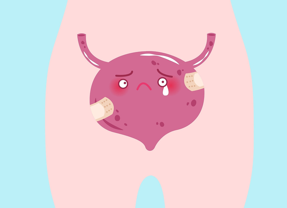 A battered bladder. A bladder prolapse