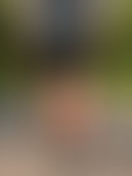 Calf Muscles and Plantar Fascia