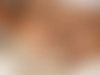 Parasites vs Dysbiosis vs SIBO: Same Symptoms, Different Roots