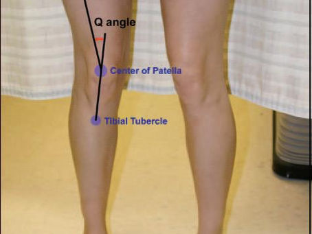 The correction of valgus knee fault in squatting, focusing on the common ‘knees out’ cue.
